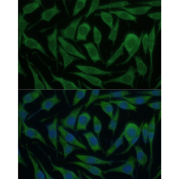 Immunofluorescence - Anti-KIF14 Antibody (A8568) - Antibodies.com