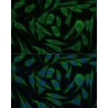 Immunofluorescence - Anti-KIF14 Antibody (A8568) - Antibodies.com