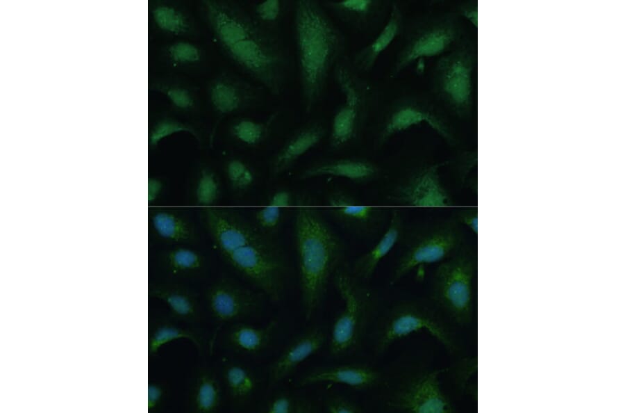 Immunofluorescence - Anti-KIF14 Antibody (A8568) - Antibodies.com
