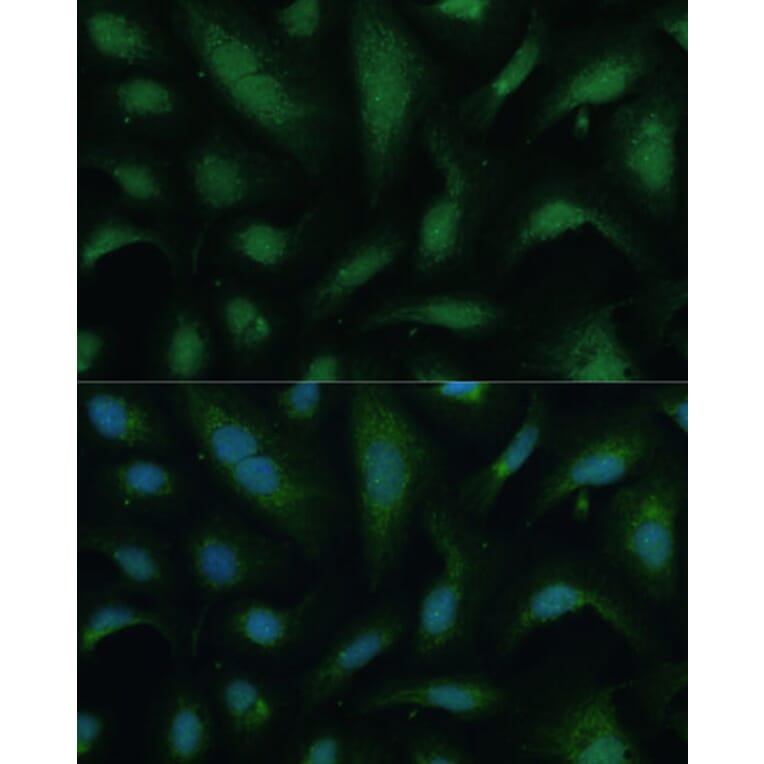 Immunofluorescence - Anti-KIF14 Antibody (A8568) - Antibodies.com