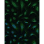 Immunofluorescence - Anti-KIF14 Antibody (A8568) - Antibodies.com