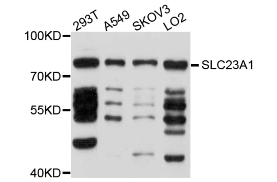 Western Blot - Anti-SLC23A1 Antibody (A10276) - Antibodies.com