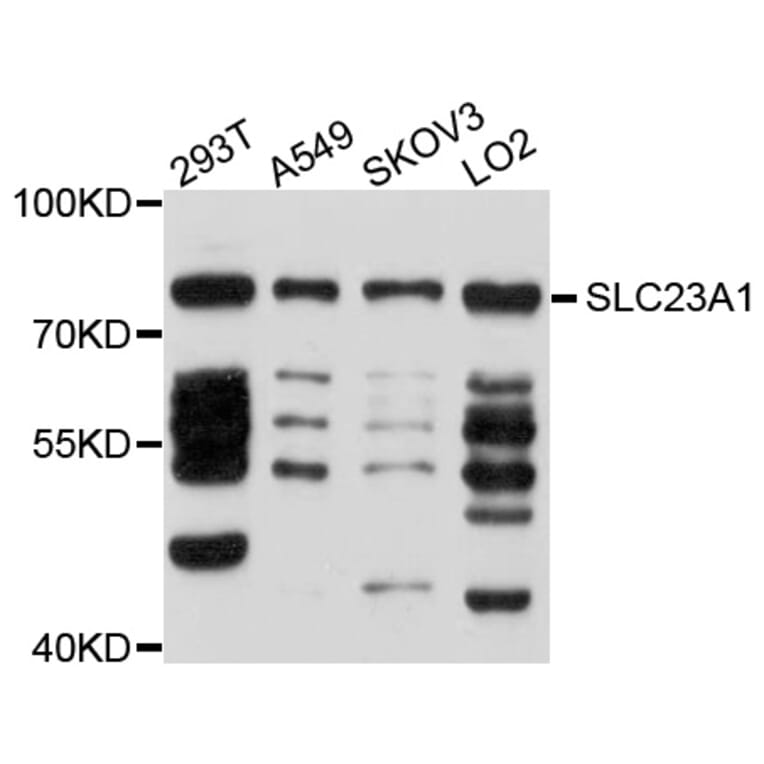 Western Blot - Anti-SLC23A1 Antibody (A10276) - Antibodies.com