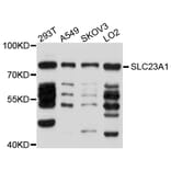 Western Blot - Anti-SLC23A1 Antibody (A10276) - Antibodies.com