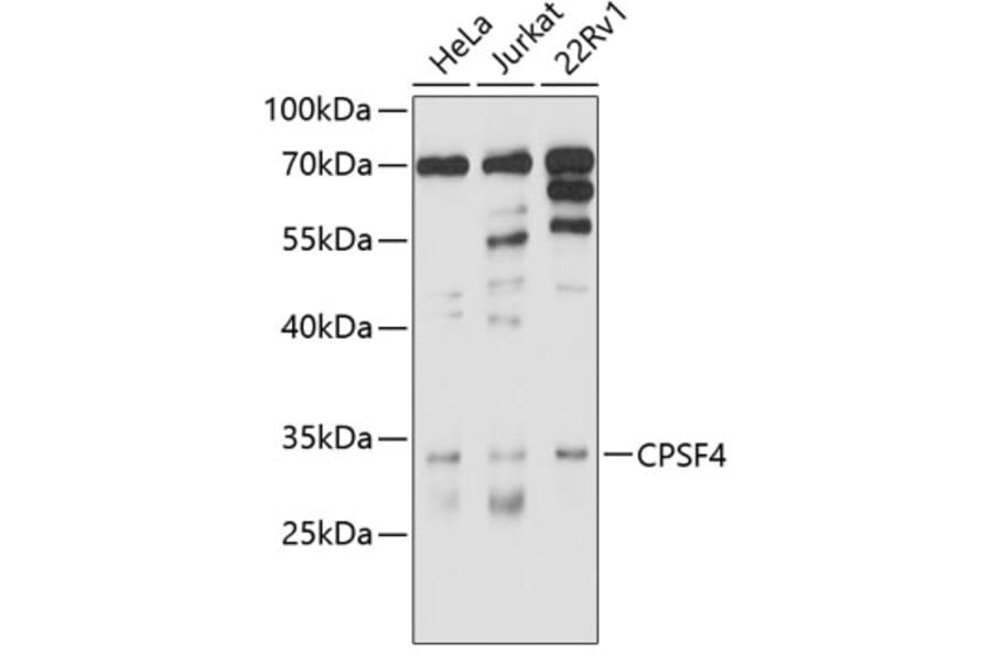 Western Blot - Anti-CPSF30/NAR Antibody (A8572) - Antibodies.com