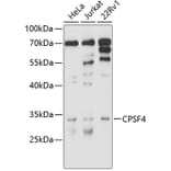 Western Blot - Anti-CPSF30/NAR Antibody (A8572) - Antibodies.com