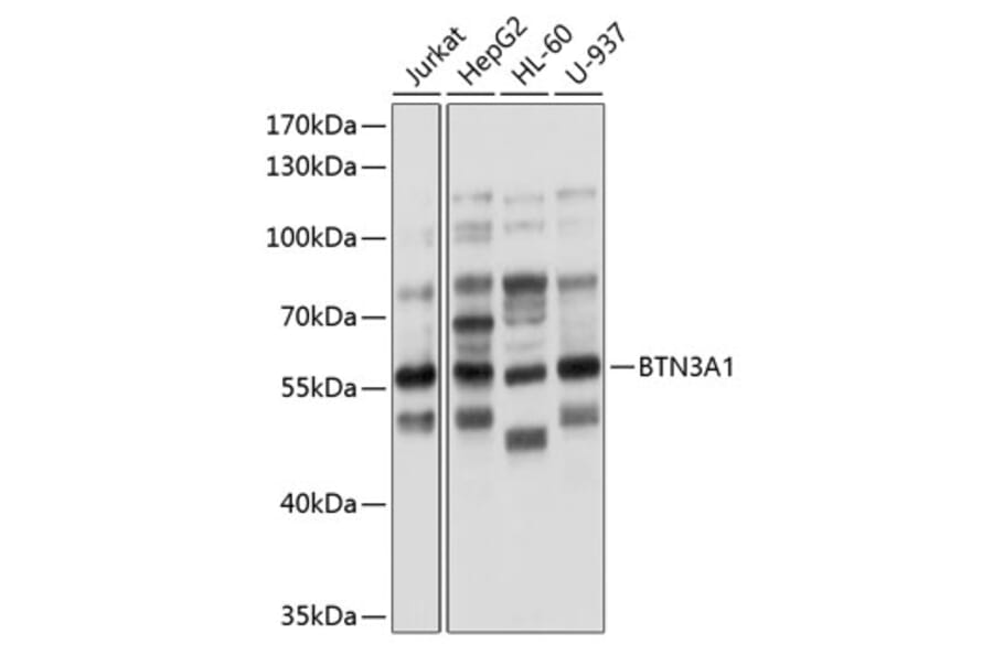Western Blot - Anti-BTN3A1 Antibody (A8573) - Antibodies.com