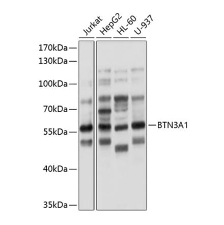 Western Blot - Anti-BTN3A1 Antibody (A8573) - Antibodies.com