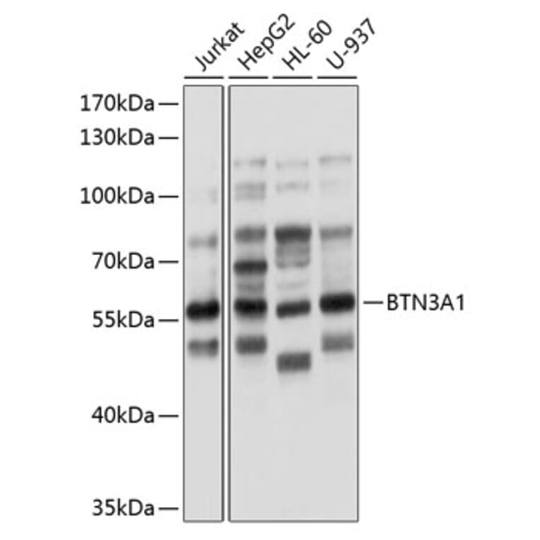 Western Blot - Anti-BTN3A1 Antibody (A8573) - Antibodies.com
