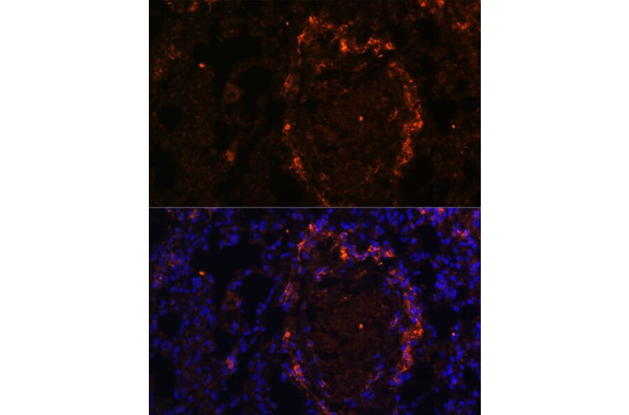Immunofluorescence - Anti-BTN3A1 Antibody (A8573) - Antibodies.com