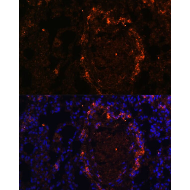 Immunofluorescence - Anti-BTN3A1 Antibody (A8573) - Antibodies.com