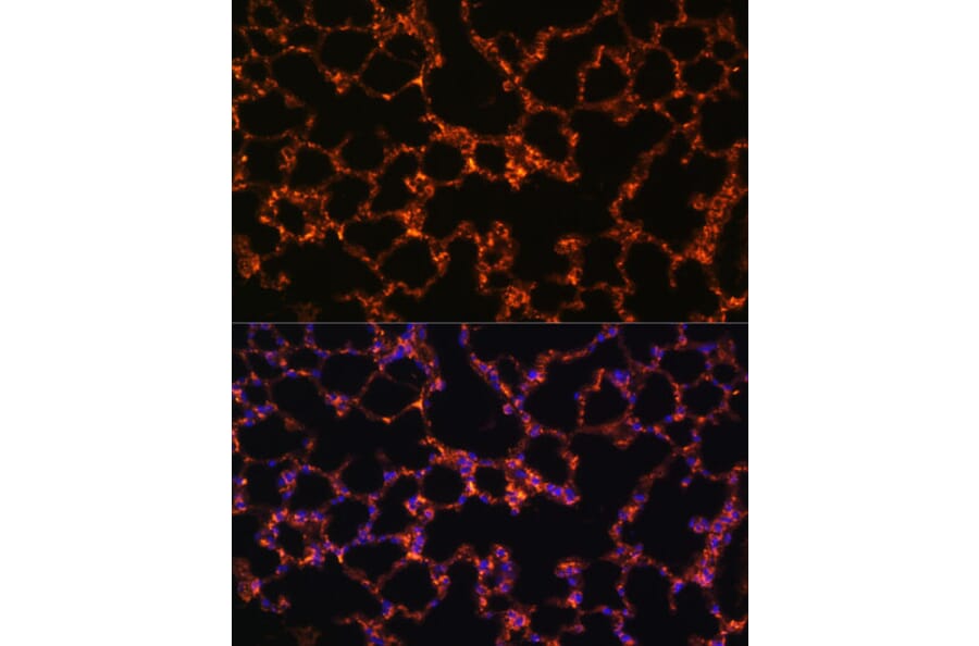 Immunofluorescence - Anti-BTN3A1 Antibody (A8573) - Antibodies.com