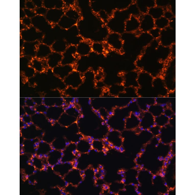 Immunofluorescence - Anti-BTN3A1 Antibody (A8573) - Antibodies.com
