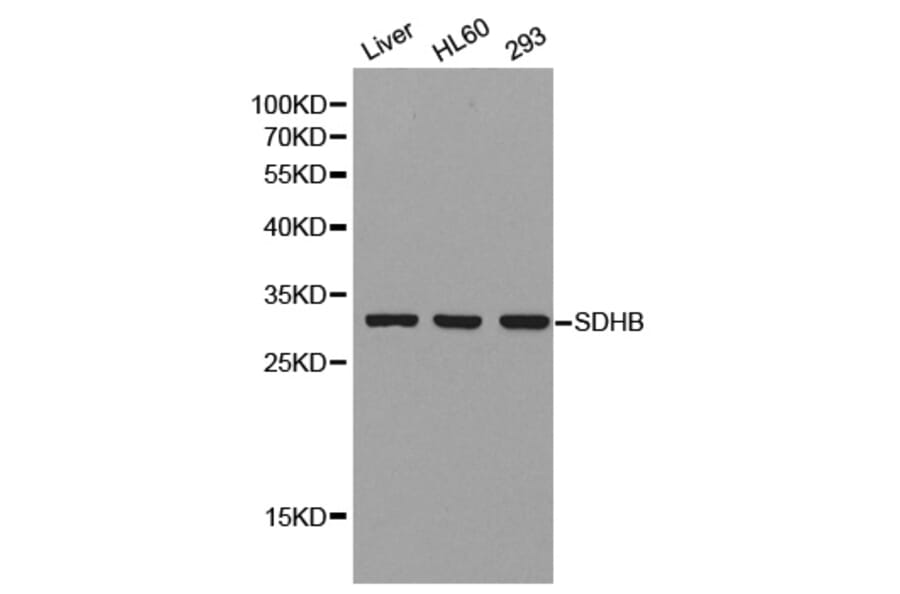 Western Blot - Anti-SDHB Antibody (A1029) - Antibodies.com