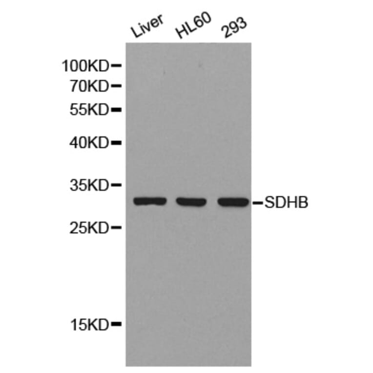Western Blot - Anti-SDHB Antibody (A1029) - Antibodies.com