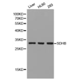 Western Blot - Anti-SDHB Antibody (A1029) - Antibodies.com