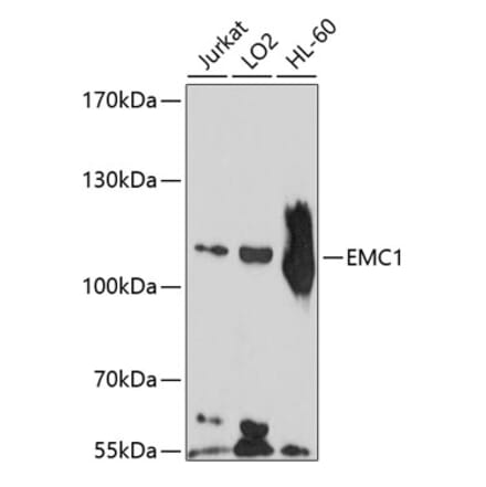 Western Blot - Anti-KIAA0090 Antibody (A8575) - Antibodies.com