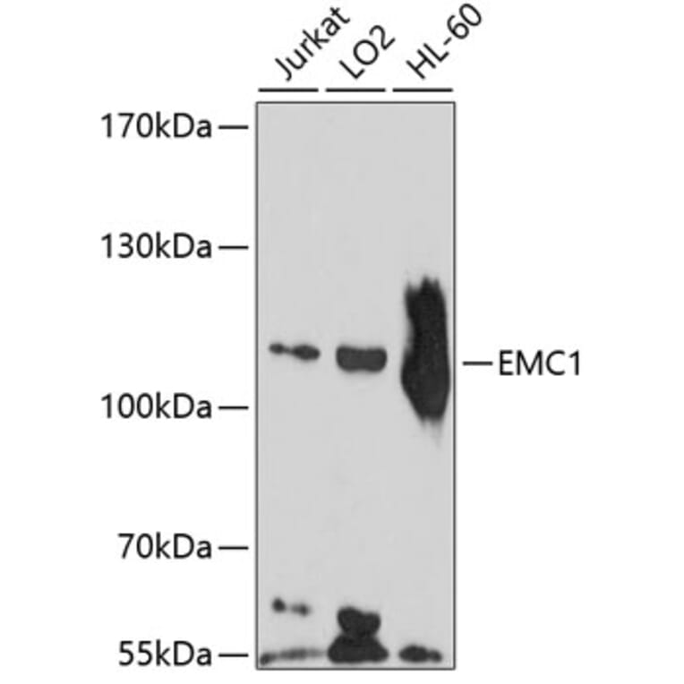 Western Blot - Anti-KIAA0090 Antibody (A8575) - Antibodies.com