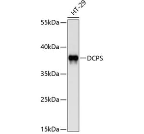 Western Blot - Anti-DCPS Antibody (A8576) - Antibodies.com