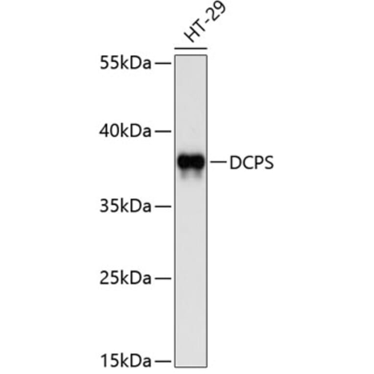 Western Blot - Anti-DCPS Antibody (A8576) - Antibodies.com