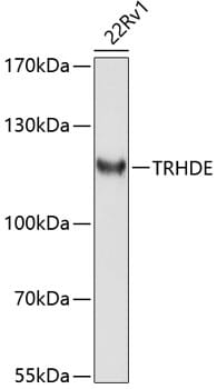 Western blot analysis of extracts of 22Rv1 cells, using Anti-TRHDE Antibody (A10300) at 1:1,000 dilution.
Secondary antibody: Goat Anti-Rabbit IgG (H+L) (HRP) (AS014) at 1:10,000 dilution.
Lysates / proteins: 25µg per lane.
Blocking buffer: 3% non-fat dry milk in TBST.
Detection: ECL Enhanced Kit (RM00021).
Exposure time: 90s.