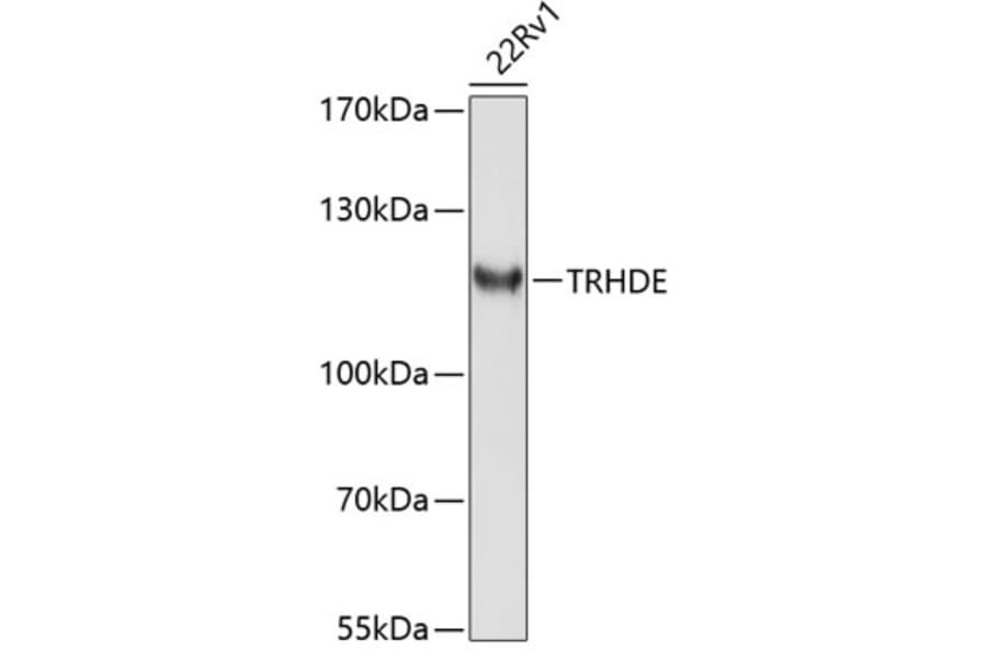 Western Blot - Anti-TRHDE Antibody (A8577) - Antibodies.com