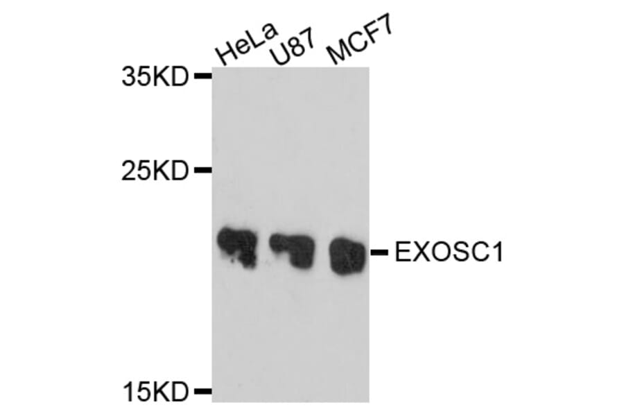 Western Blot - Anti-EXOSC1 Antibody (A10302) - Antibodies.com