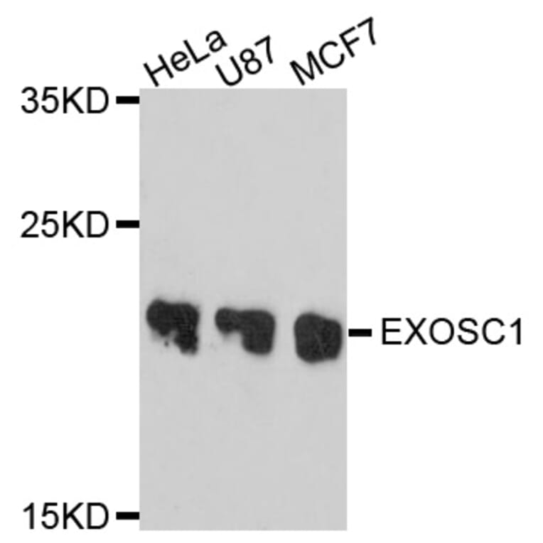 Western Blot - Anti-EXOSC1 Antibody (A10302) - Antibodies.com