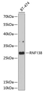 Western blot analysis of extracts of BT-474 cells, using Anti-RNF138 Antibody (A10304) at 1:1,000 dilution.
Secondary antibody: Goat Anti-Rabbit IgG (H+L) (HRP) (AS014) at 1:10,000 dilution.
Lysates / proteins: 25µg per lane.
Blocking buffer: 3% non-fat dry milk in TBST.
Detection: ECL Basic Kit (RM00020).
Exposure time: 90s.