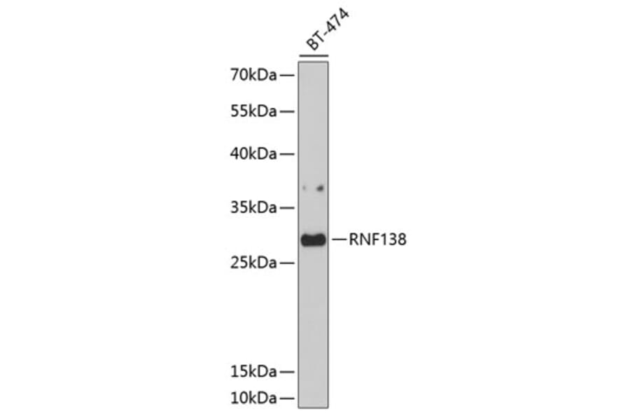 Western Blot - Anti-RNF138/HSD-4 Antibody (A8579) - Antibodies.com
