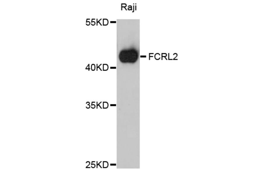 Western Blot - Anti-FCRL2 Antibody (A10324) - Antibodies.com