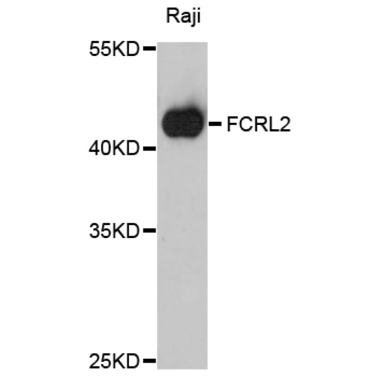 Western Blot - Anti-FCRL2 Antibody (A10324) - Antibodies.com