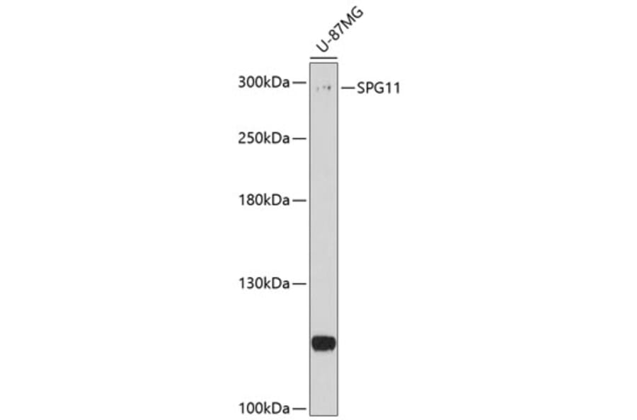 Western Blot - Anti-SPG11 Antibody (A10326) - Antibodies.com
