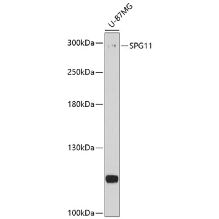 Western Blot - Anti-SPG11 Antibody (A10326) - Antibodies.com