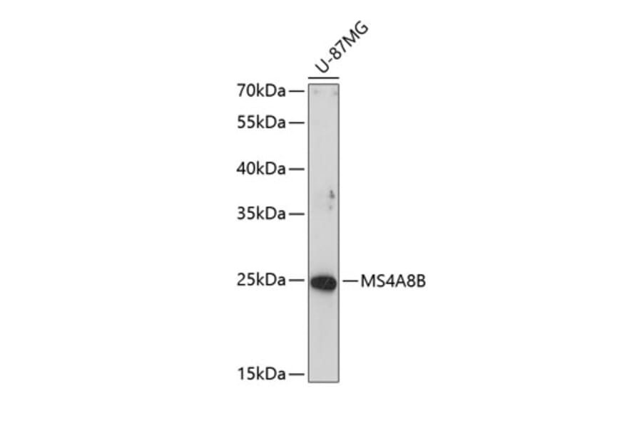 Western Blot - Anti-MS4A8 Antibody (A8584) - Antibodies.com
