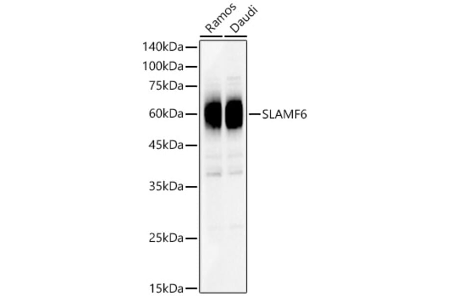 Western Blot - Anti-SLAMF6 Antibody (A8585) - Antibodies.com