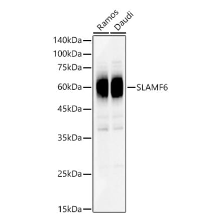 Western Blot - Anti-SLAMF6 Antibody (A8585) - Antibodies.com