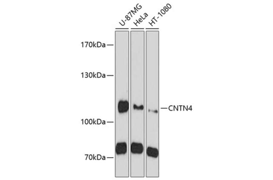 Western Blot - Anti-CNTN4 Antibody (A10339) - Antibodies.com