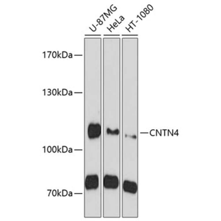 Western Blot - Anti-CNTN4 Antibody (A10339) - Antibodies.com