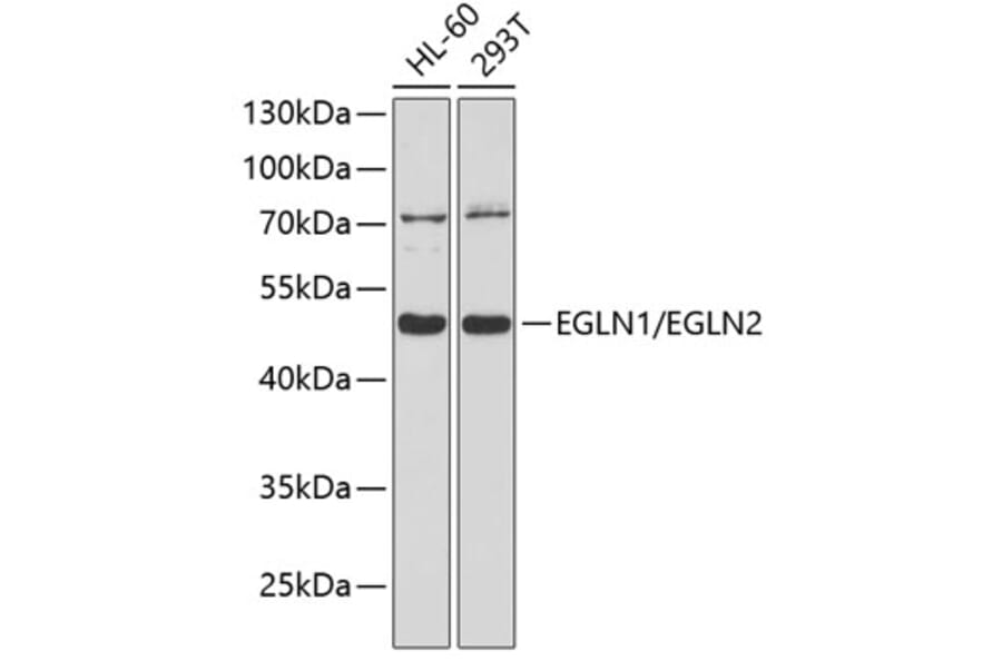 Western Blot - Anti-PHD1/prolyl hydroxylase + PHD2/prolyl hydroxylase Antibody (A8587) - Antibodies.com