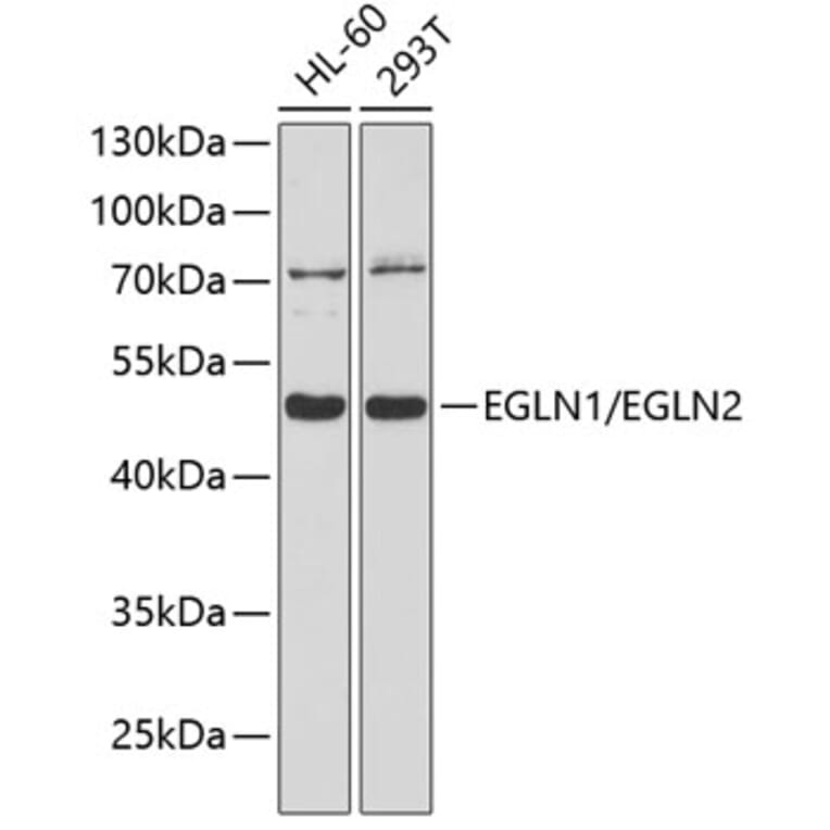 Western Blot - Anti-PHD1/prolyl hydroxylase + PHD2/prolyl hydroxylase Antibody (A8587) - Antibodies.com