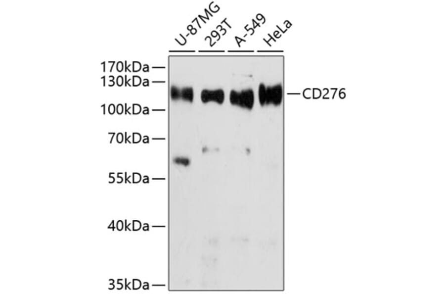 Western Blot - Anti-CD276 Antibody (A10347) - Antibodies.com