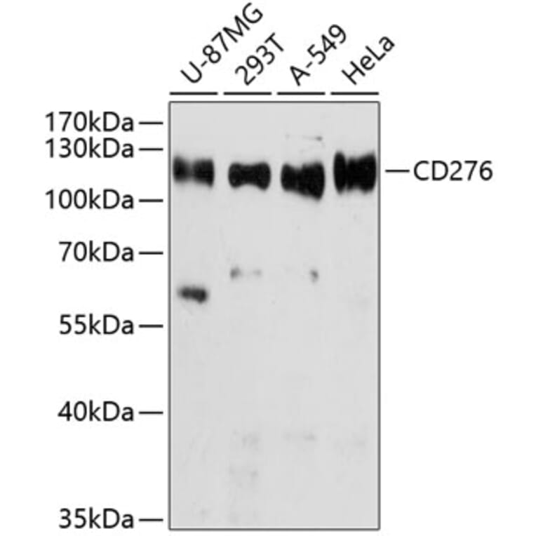 Western Blot - Anti-CD276 Antibody (A10347) - Antibodies.com