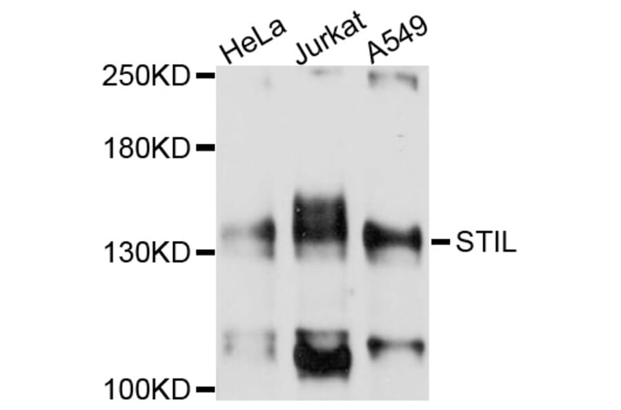 Western Blot - Anti-STIL Antibody (A10350) - Antibodies.com
