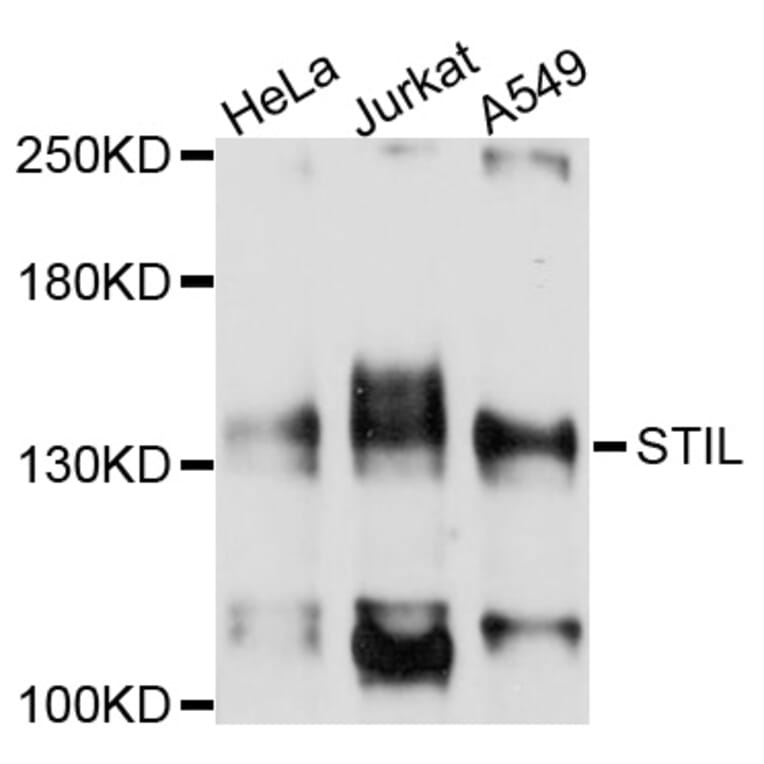 Western Blot - Anti-STIL Antibody (A10350) - Antibodies.com