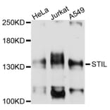 Western Blot - Anti-STIL Antibody (A10350) - Antibodies.com