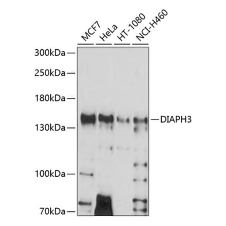 Western Blot - Anti-DIAPH3 Antibody (A8590) - Antibodies.com
