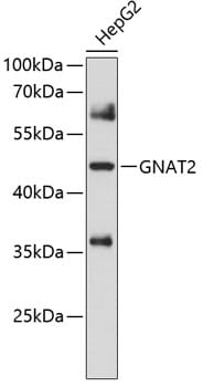 Western blot analysis of extracts of HepG2 cells, using Anti-GNAT2 Antibody (A10352) at 1:1,000 dilution.
Secondary antibody: Goat Anti-Rabbit IgG (H+L) (HRP) (AS014) at 1:10,000 dilution.
Lysates / proteins: 25µg per lane.
Blocking buffer: 3% non-fat dry milk in TBST.
Detection: ECL Basic Kit (RM00020).
Exposure time: 15s.