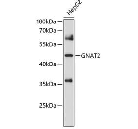 Western Blot - Anti-GNAT2 Antibody (A8591) - Antibodies.com