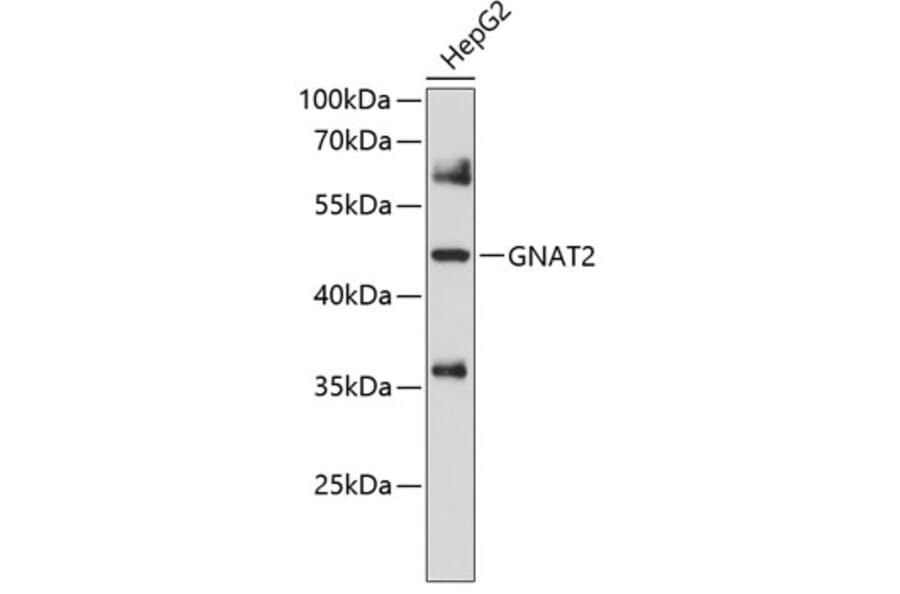 Western Blot - Anti-GNAT2 Antibody (A8591) - Antibodies.com